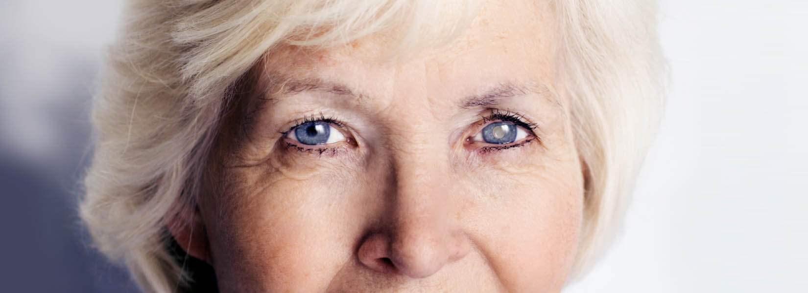 Cataract Surgery in Clay